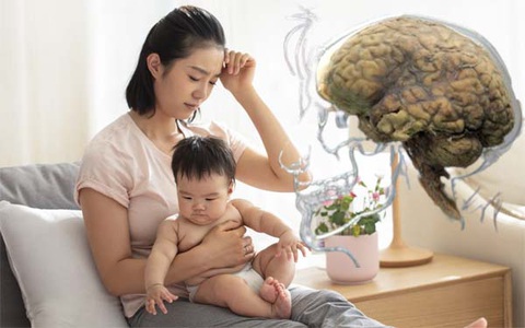 Các mẹ có thể bị "mất não" tới 2 năm sau khi sinh, nguyên nhân khiến ai cũng bất ngờ