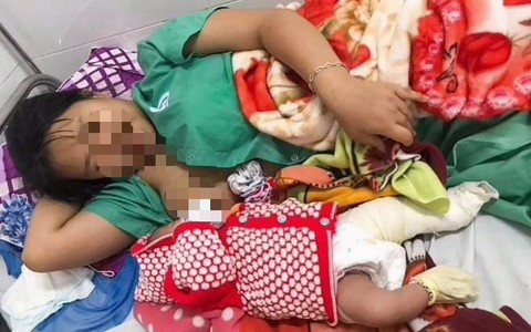 Quảng Nam: Bé trai sơ sinh bị gãy xương đùi sau ca mổ lấy thai của mẹ