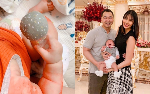 Lan Khuê kể chuyện con bị chàm nhưng nhìn cánh tay cậu bé ai cũng khen mẹ nức nở vì lý do này
