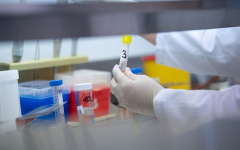 Bộ Y tế: Bệnh viện Nhi đồng 1 được xét nghiệm virus gây bệnh COVID-19