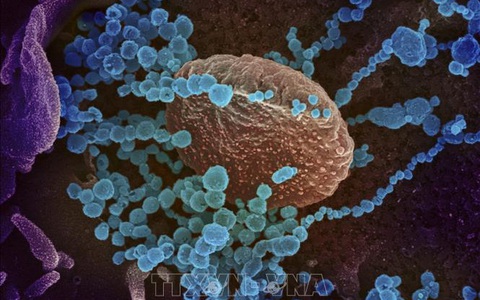 Các nhà khoa học Argentina giải mã thành công bộ gen của virus SARS-COV-2