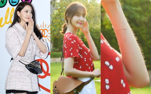 Ngoài chân vòng kiềng, Yoona còn có thêm nhược điểm mà tinh mắt lắm mới nhận ra: Thậm chí đó còn là nỗi khổ của đa số các chị em 