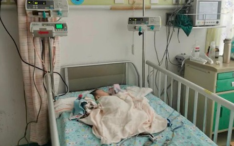 Bé 6 tháng tuổi móp đầu, bất tỉnh tại chỗ sau khi bị 2 chai dầu gội từ tầng cao chung cư rơi trúng 