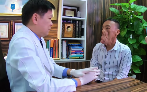 Chuyện người đàn ông mang "khuôn mặt quỷ" đến Sài Gòn tìm lại khuôn mặt người