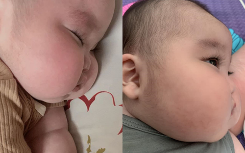 Nhìn đôi má bánh bao của "cậu bé Bút Chì" phiên bản đời thực, chẳng ai ngờ bé từng sinh non đến 1 tháng