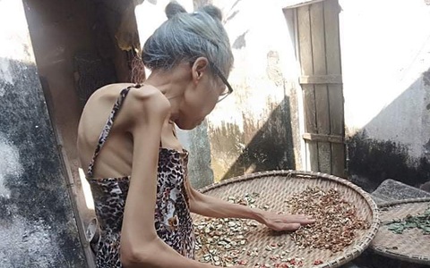 Nỗi day dứt của người đàn bà lưng gù sinh ra con mà không thể nuôi con: “Chỉ mong con thấu hiểu cho nỗi lòng của mẹ”