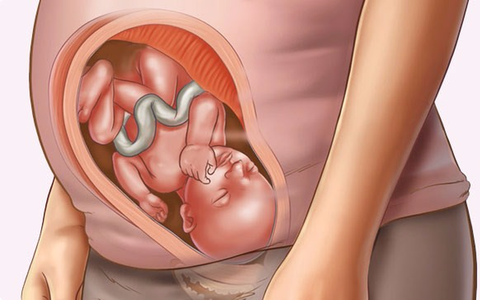 Làm thế nào để phòng dị tật ống thần kinh cho trẻ?