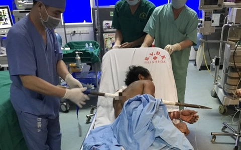 Thanh Hóa: Người đàn ông bị thanh xà beng dài 1 mét đâm xuyên người, may mắn được cứu sống