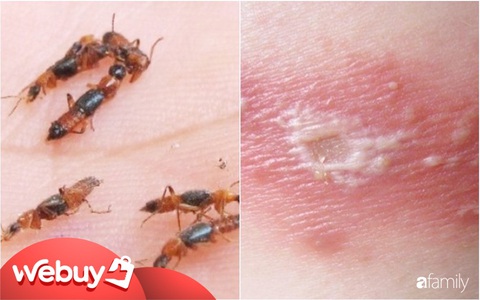 Kiến ba khoang lại xuất hiện và đây là 3 sản phẩm đối phó hiệu quả