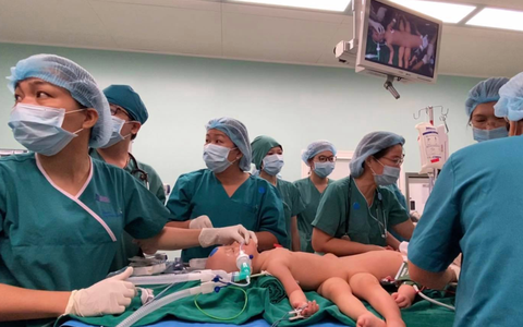 Xúc động từng khoảnh khắc trong ca phẫu thuật tách rời hai bé dính nhau: Cuộc đại phẫu cân não của 5 ê-kíp bác sĩ