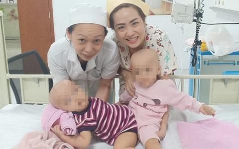 Báo Anh đưa tin bác sĩ Việt Nam tách thành công hai bé song sinh dính liền