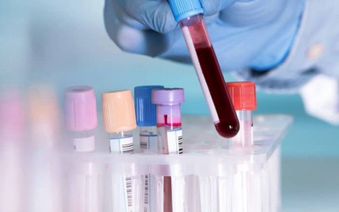 Các nhà khoa học đã tìm ra nguồn gốc của đông máu do COVID-19