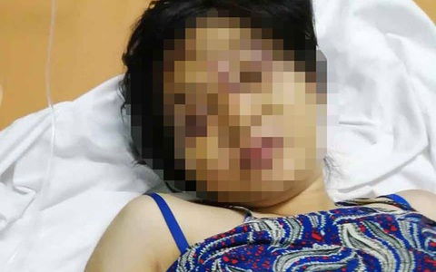 Cô gái ở Bình Chánh bị hành hạ đến sảy thai