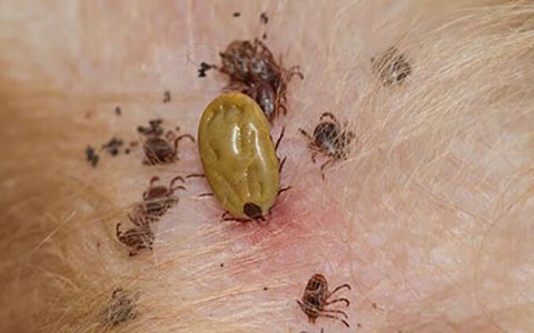 Virus Bunya bùng phát ở Trung Quốc: Đã xuất hiện từ 10 năm trước, gây chết người, lây bệnh qua máu và vết thương hở