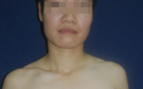 Mắc bệnh lạ, nữ sinh chết điếng với chỉ định của bác sĩ