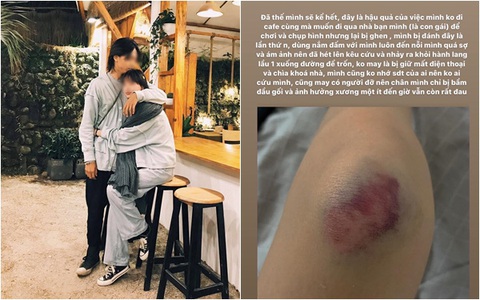 Drama mẫu nữ Sài Gòn sinh năm 2000 tố bị bạn trai hành hung, nam chính lên tiếng: "Chúng tôi chưa chia tay, cô ấy nói đều không đúng sự thật"
