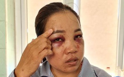 Người đàn bà bị chồng cũ tìm đến tận nhà đánh đập dã man