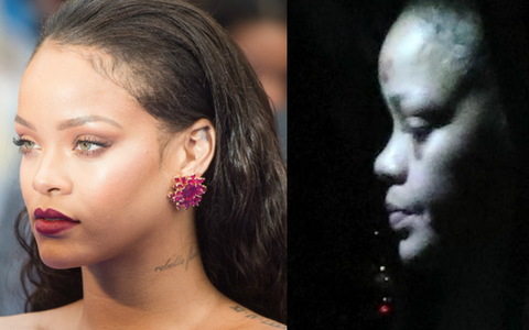 Dân tình tá hỏa trước loạt ảnh Rihanna mặt bầm tím khi xuống phố, đại diện mãi mới hé lộ về vụ tai nạn gần đây