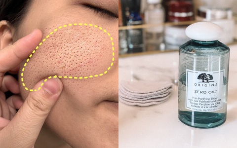 5 loại toner cho da hỗn hợp thiên dầu, giúp lỗ chân lông nhỏ mịn và bã nhờn cũng được giảm đáng kể 