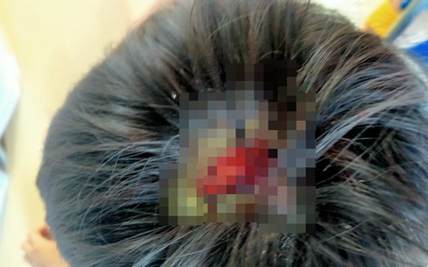 CLIP: Bé 9 tuổi kể việc bị cha bạo hành đến toác đầu, mẻ răng