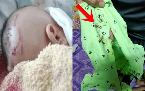 Đặt con 7 tuần tuổi một mình ở phòng khách rồi nghe thấy tiếng khóc, bà mẹ tức tốc chạy vào chứng kiến cảnh tượng đẫm máu