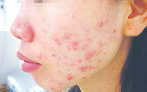 Sát Tết, lại khổ vì mỹ phẩm giả