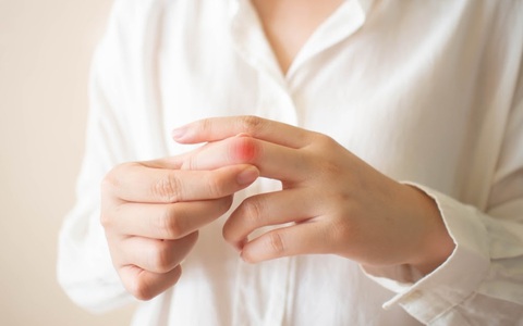 Thường xuyên bị tê mỏi tay, hãy cảnh giác vì nó có thể là dấu hiệu của 5 căn bệnh nguy hiểm này