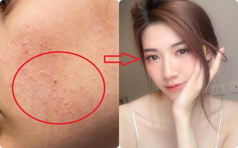 Chăm sóc da mùa đông thế nào để làn da "khô như ngói" căng bóng mịn màng