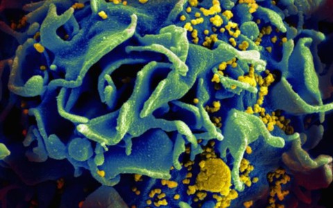 Người phụ nữ 30 tuổi tự hết virus HIV dù không điều trị