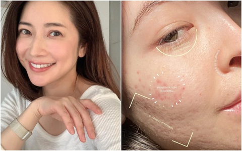 Chăm sóc da tuổi 35+: Chọn đúng thành phần này không kể đêm hay ngày, làn da đều mịn màng không gợn nếp nhăn