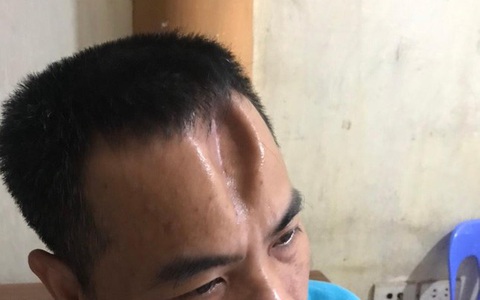 Dùng cào sắt đánh lún sọ, dập não hàng xóm đang phơi thóc