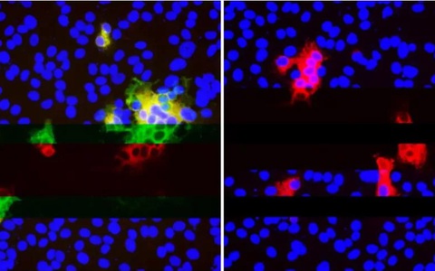 Virus SARS-CoV-2 đột biến đang "lén lút" qua mắt hệ miễn dịch bằng cách nào?