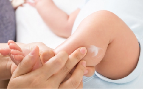 Cảnh báo dưỡng ẩm cho bé có thể làm tăng nguy cơ mắc chứng dị ứng