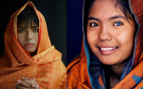 Thạch Thị Sa Pa - Nữ sinh người Chăm với đôi mắt 2 màu "ma mị" hiếm thấy ngày ấy giờ càng xinh xắn, tiết lộ mong muốn sau khi tốt nghiệp đại học