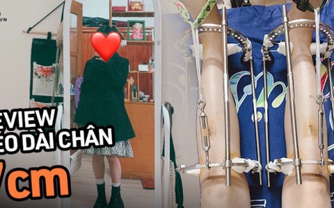 Nghe cô nàng review trọn quá trình kéo dài chân thêm 7cm tại viện 108 mới thấy: Để đẹp bạn còn cần phải dũng cảm nữa!