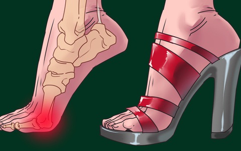 Đi giày cao gót nhiều mà không tập 5 động tác dưới đây thì đôi chân của bạn sẽ sớm biến dạng