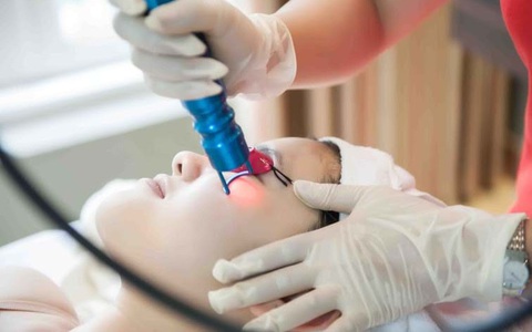 Trị nám bằng laser kiêng ăn gì?