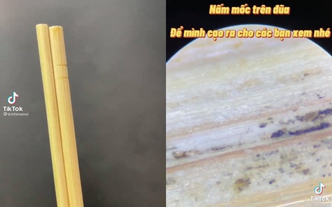 Hoảng hồn nhìn số vi khuẩn tồn tại trên loại đũa dùng 1 lần, ai tinh mắt sẽ thấy đặc điểm "tố cáo" nó đã được tái chế bao nhiêu lần