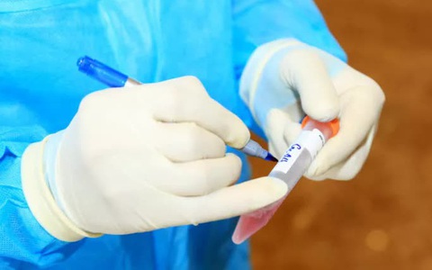 Thêm 3 ca dương tính SARS-COV-2 liên quan cụ ông 74 tuổi thuê thợ về làm cửa