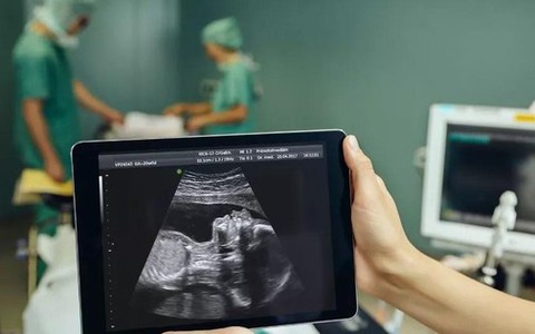 Phẫu thuật thành công nứt đốt sống cho thai nhi trong bụng mẹ