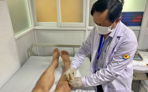 Đưa chỉ tự tan vào huyệt đạo: Chỉ 30 phút 1 lần có thể cải thiện hàng loạt bệnh ở 5 hệ