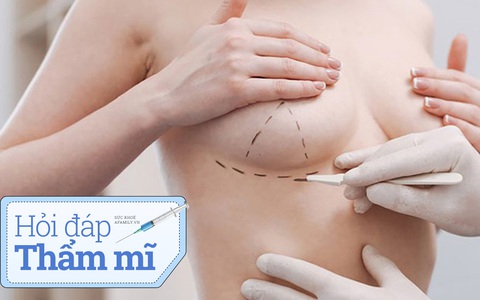 Hỏi đáp cùng bác sĩ thẩm mỹ: Chưa sinh con có nên nâng ngực?