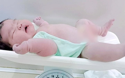 Hà Tĩnh: Bé gái chào đời nặng đến 6,2kg