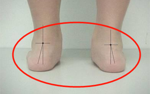 Cháu trai 4 tuổi chân bị biến dạng, bà ngoại khóc hết nước mắt vì hối hận với việc làm của mình