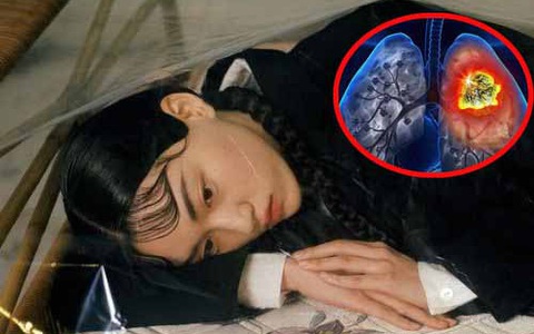 Miệng có mùi đặc biệt này không ung thư thì cũng suy thận, tiểu đường, can thiệp sớm sẽ phòng ngừa các biến chứng nguy hiểm