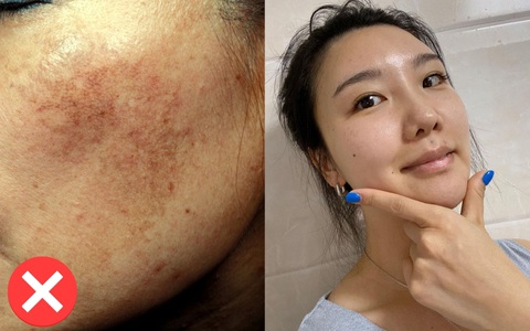 4 sai lầm nghiêm trọng khiến da bạn mãi xỉn màu, không thể sáng lên tông nào dù vất vả skincare