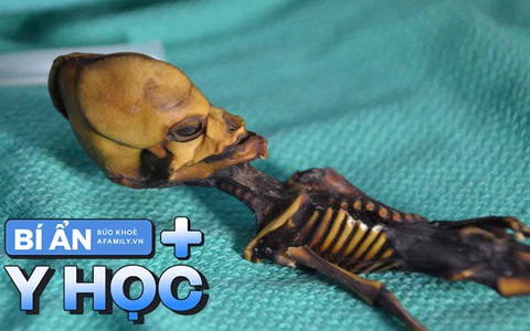 Bí ẩn về "xác ướp ngoài hành tinh" dài 13cm ở sa mạc khô nhất thế giới: 18 năm sau mới phát hiện sự thật đầy đau lòng