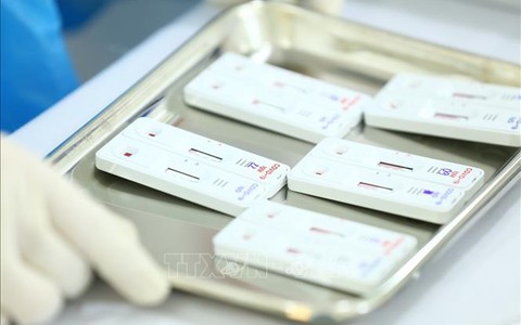 Công khai việc có hay không kit xét nghiệm phát hiện Omicron