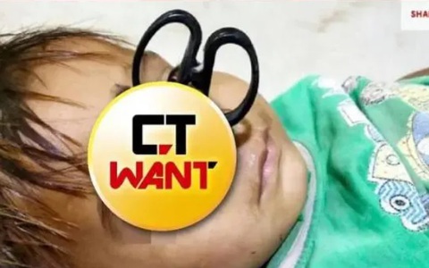 Bố mẹ bất cẩn khiến con trai bị tai nạn thương tâm, nhìn vết thương ai cũng phải xót xa cho đứa trẻ