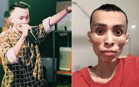 Nam rapper Việt qua đời vì bệnh ung thư ở tuổi 27: Cảnh báo loại ung thư nguy hiểm ai cũng có thể mắc, dấu hiệu bệnh dễ nhầm lẫn với "bệnh vặt"
